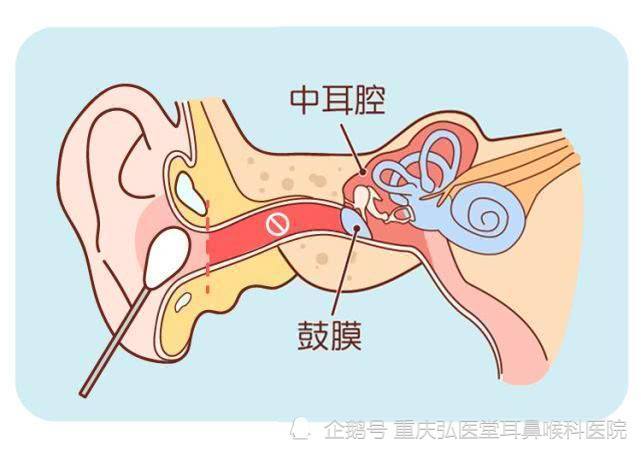 耳炎，全面解析、预防与治疗方法