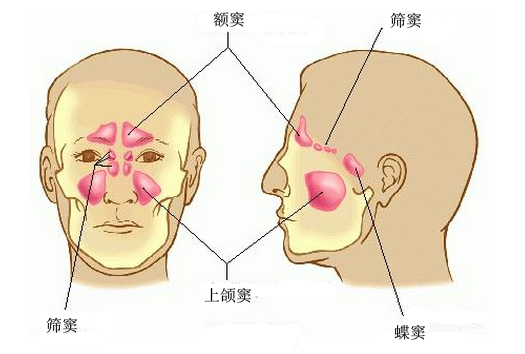 窦炎，认识、理解与管理之道