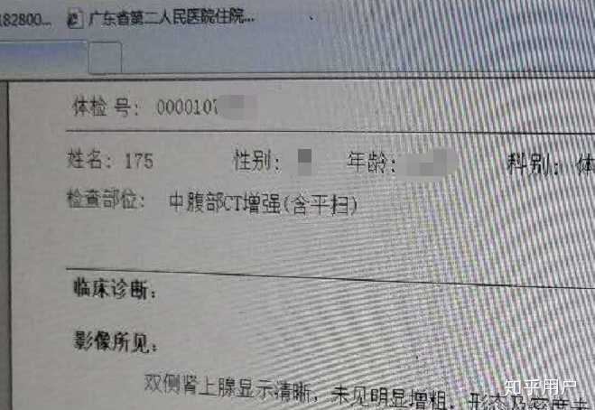 公务员后悔填病史背后的真相与启示探究